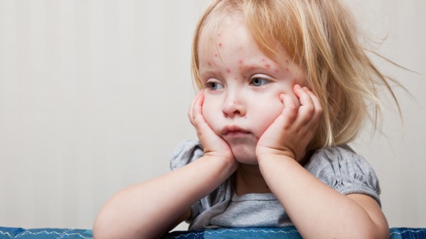 孩子手腳脫皮是為什么？如何防止冬天手腳脫皮？