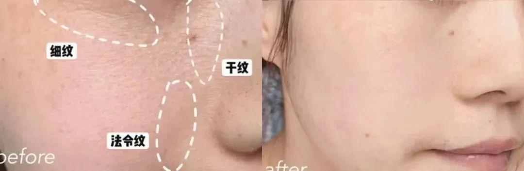貴婦級的HR赫蓮娜哪些護(hù)膚品值得最先入手（貴婦級的HR赫蓮娜哪些護(hù)膚品值得最先入手）(32)