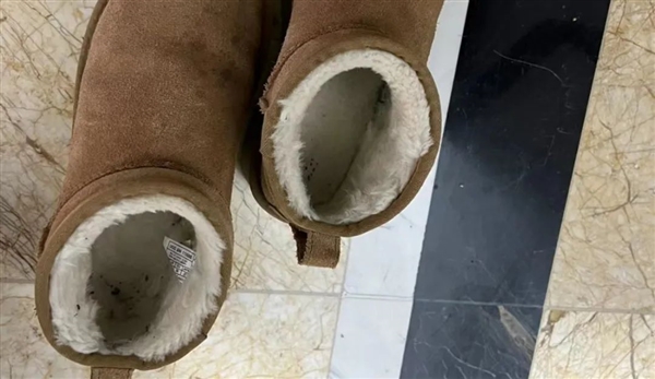 雪地靴又上熱搜！經(jīng)常穿真的很傷腳 醫(yī)生緊急提醒